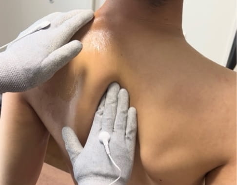 筋膜リリースの様子